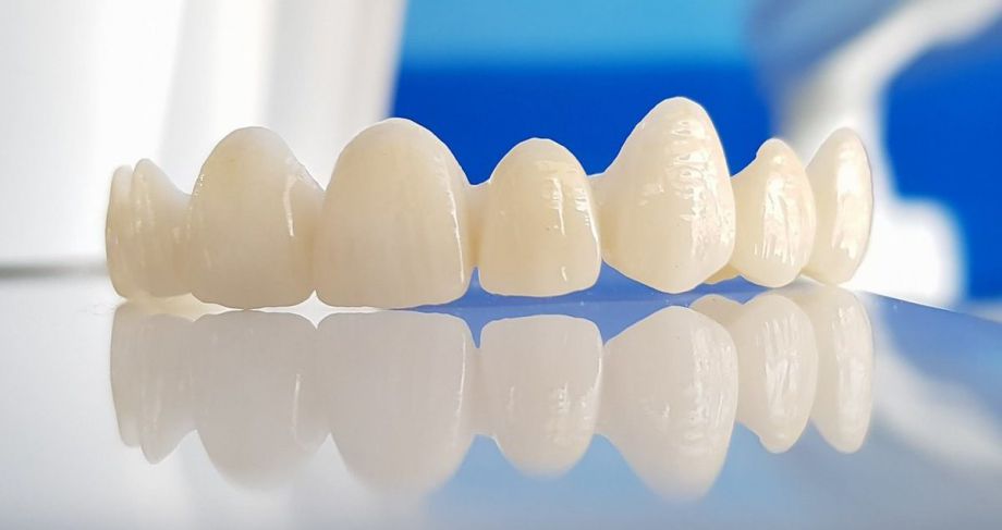 Циркониевые коронки - самый прогрессивный выбор в современной стоматологии